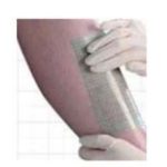 Aposito Secundario de Sujecion Flexigrid Opsite Allevyn Transparente y Adhesivo 12 X 25 Cm