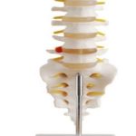 Juego de 5 Vertebras Tamaño Real con Sacro, Coxis y Hernia Discal